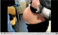 Регулировка желудочного бандажа при беременности