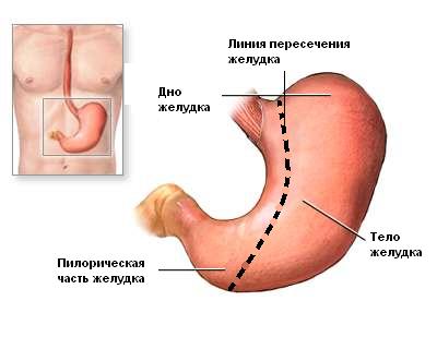 SLEEVE GASTRECTOMY -     