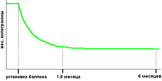 похудеть с помощью иголки